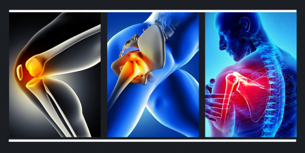 Joint Denervation Webinar Series- Knee, Hip and Shoulder Joint