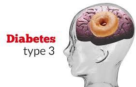 Type 3 diabetes