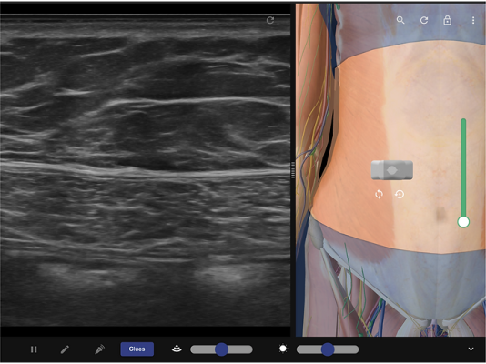 ARiRA Online regional anaesthesia course