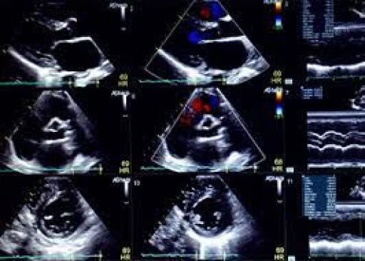 West Suffolk FUSIC & FAMUS Ultrasound course July 2024  Cancelled