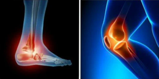 Multidisciplinary Joint Pain Management Study Day