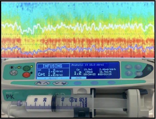 Wessex TIVA & EEG Training Day - 23rd Sept 2026